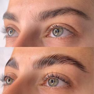 Before and After